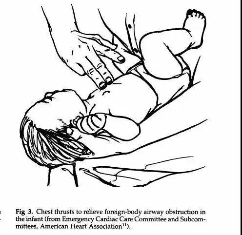 小孩吃东西呛到的最快解决方法,宝宝吃东西噎到急救视频