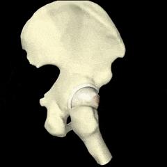 髋关节疼痛两腿不一样长如何康复,左大腿髋关节突然疼痛是什么原因