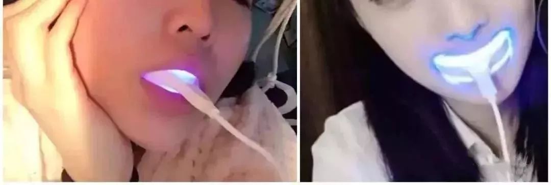 用美牙仪牙齿疼,美牙仪真的有用吗