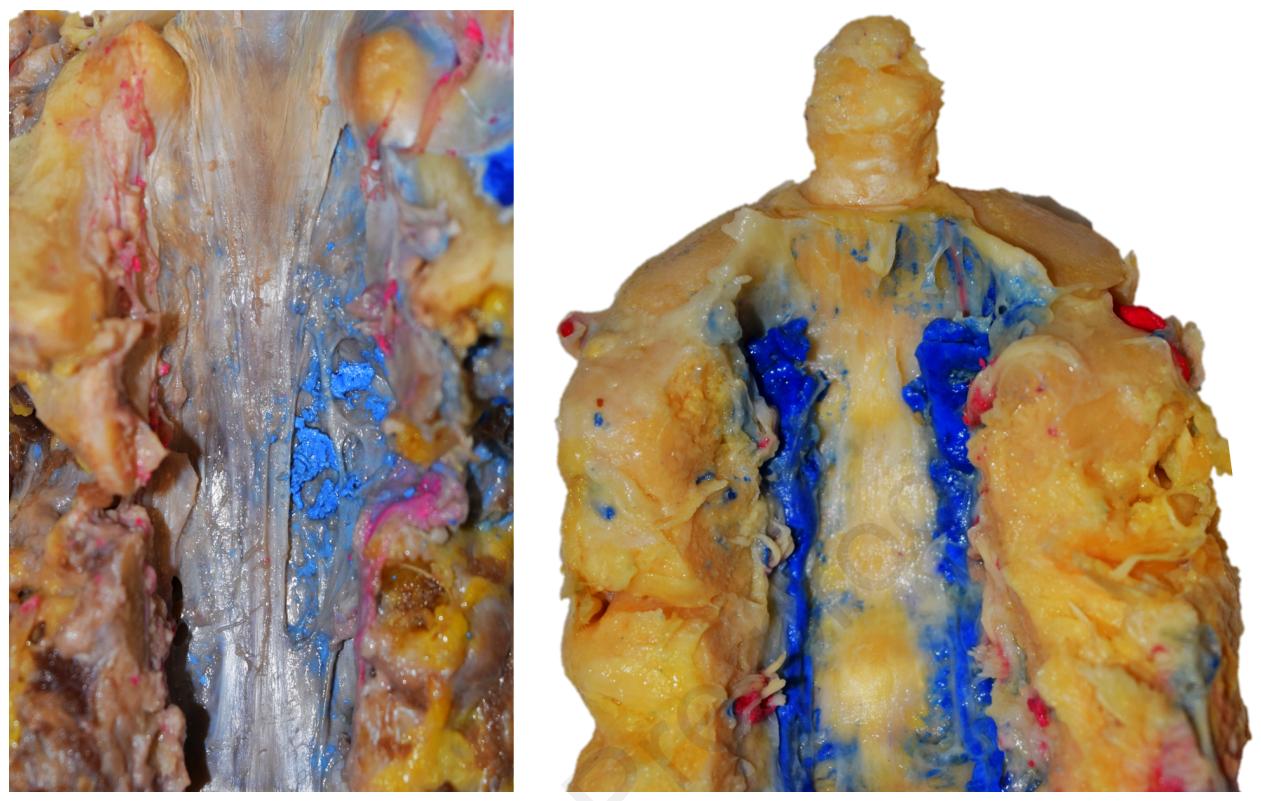 文献查阅|文献综述——椎静脉丛