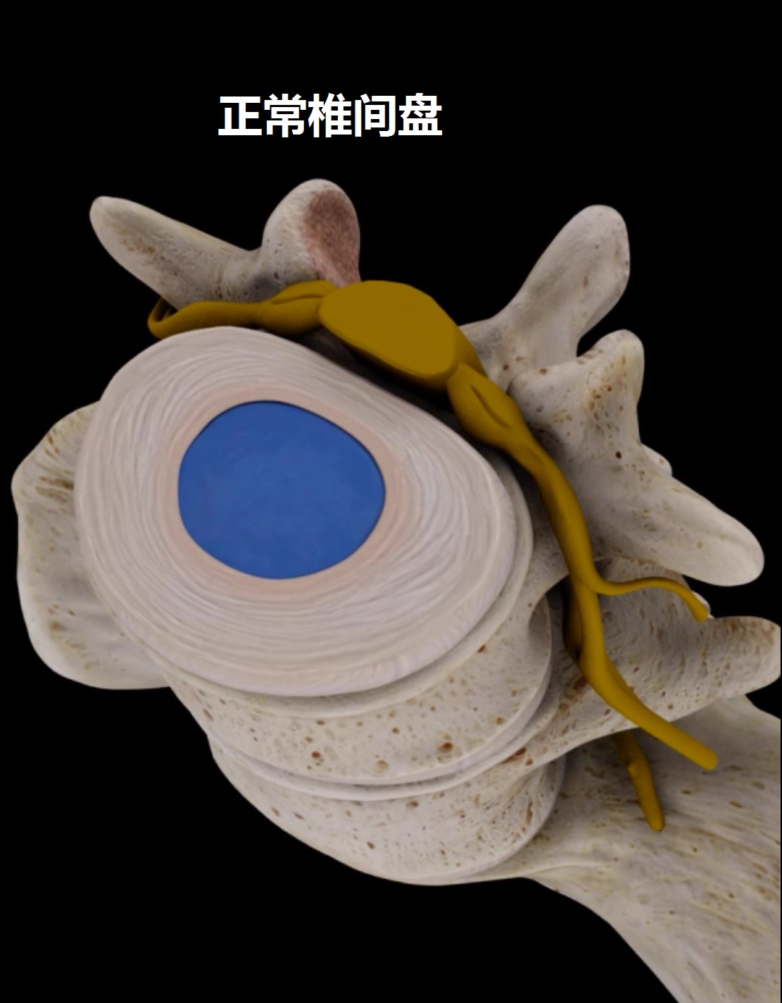 预防腰痛的正确方法,关于腰痛治疗方法有哪些