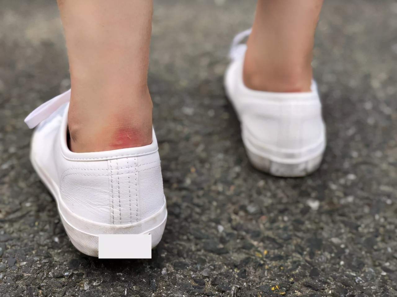 燕翠娥：一时方便足部多有不便盘点影响穿鞋的4个坏习惯