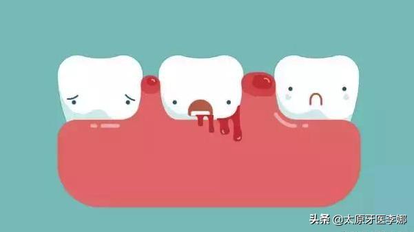 为什么我牙龈痛,为什么我牙龈肿了