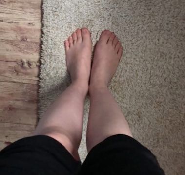 【脚控福利】拒做丑小鸭，3招解决你的“走路外八”