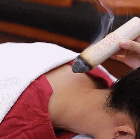 灸法千年养生之法,中医热灸养生调理