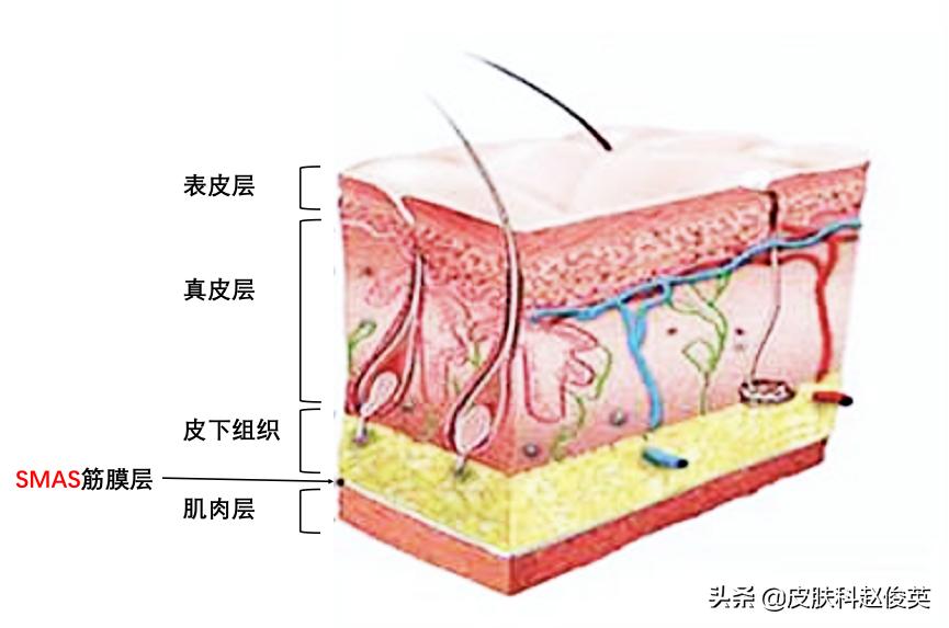 埋线科普视频,埋线美容方法视频