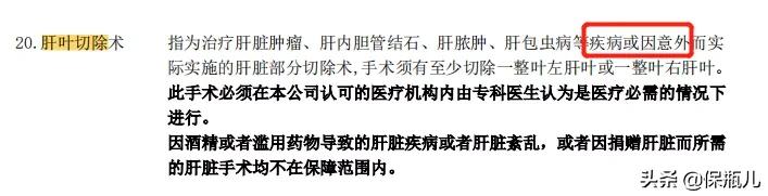新定义重疾，终于来了个不坑的产品
