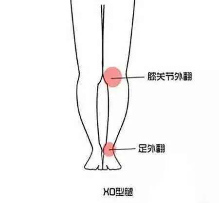 腿型不好看怎么穿搭,小短腿腿粗怎样穿搭