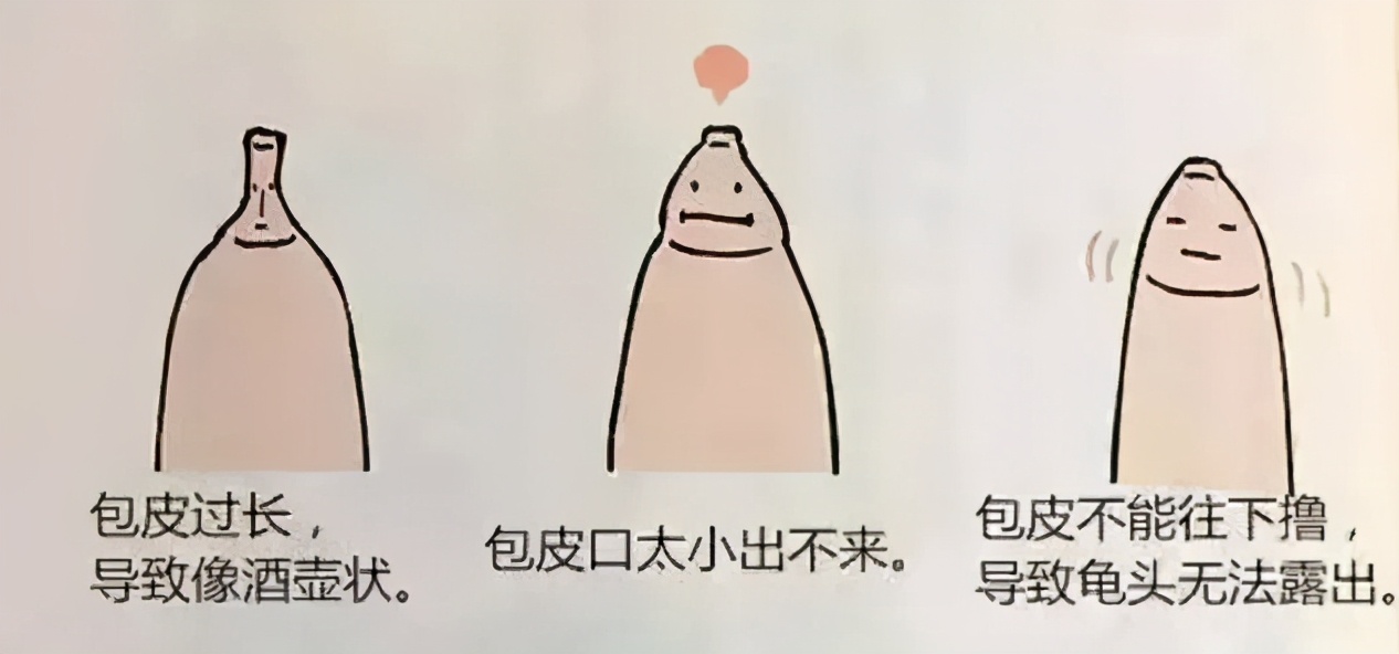 割包皮能当天做当天走吗,割包皮当天去医院当天就能割吗