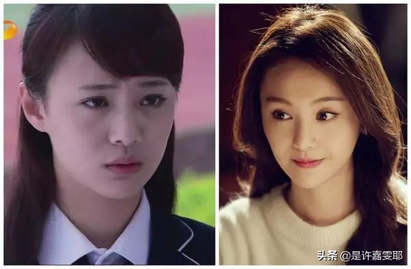 瘦脸针其实副作用挺大的吧,关于瘦脸的知识