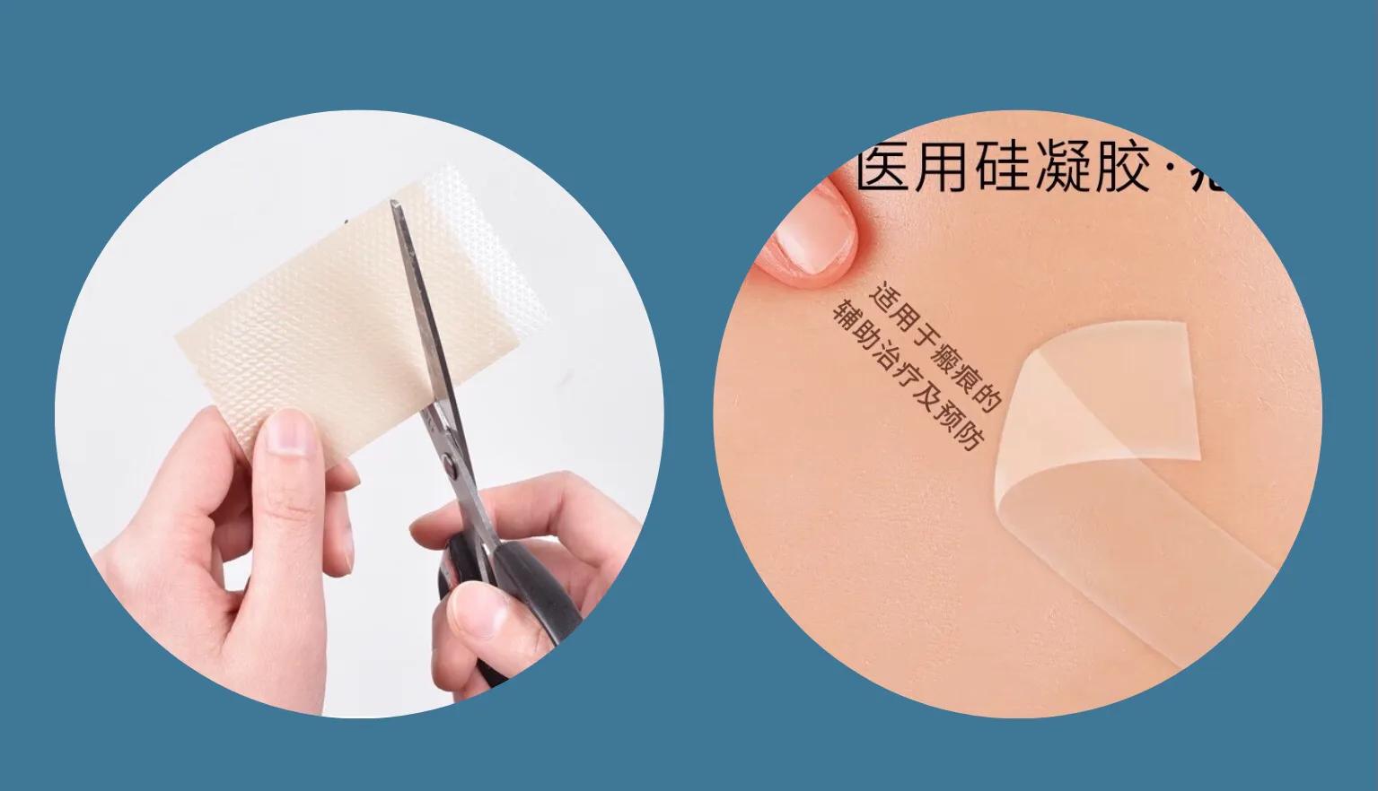 疤痕凝胶和疤痕贴怎么配合用,施可复疤痕凝胶如何正确使用