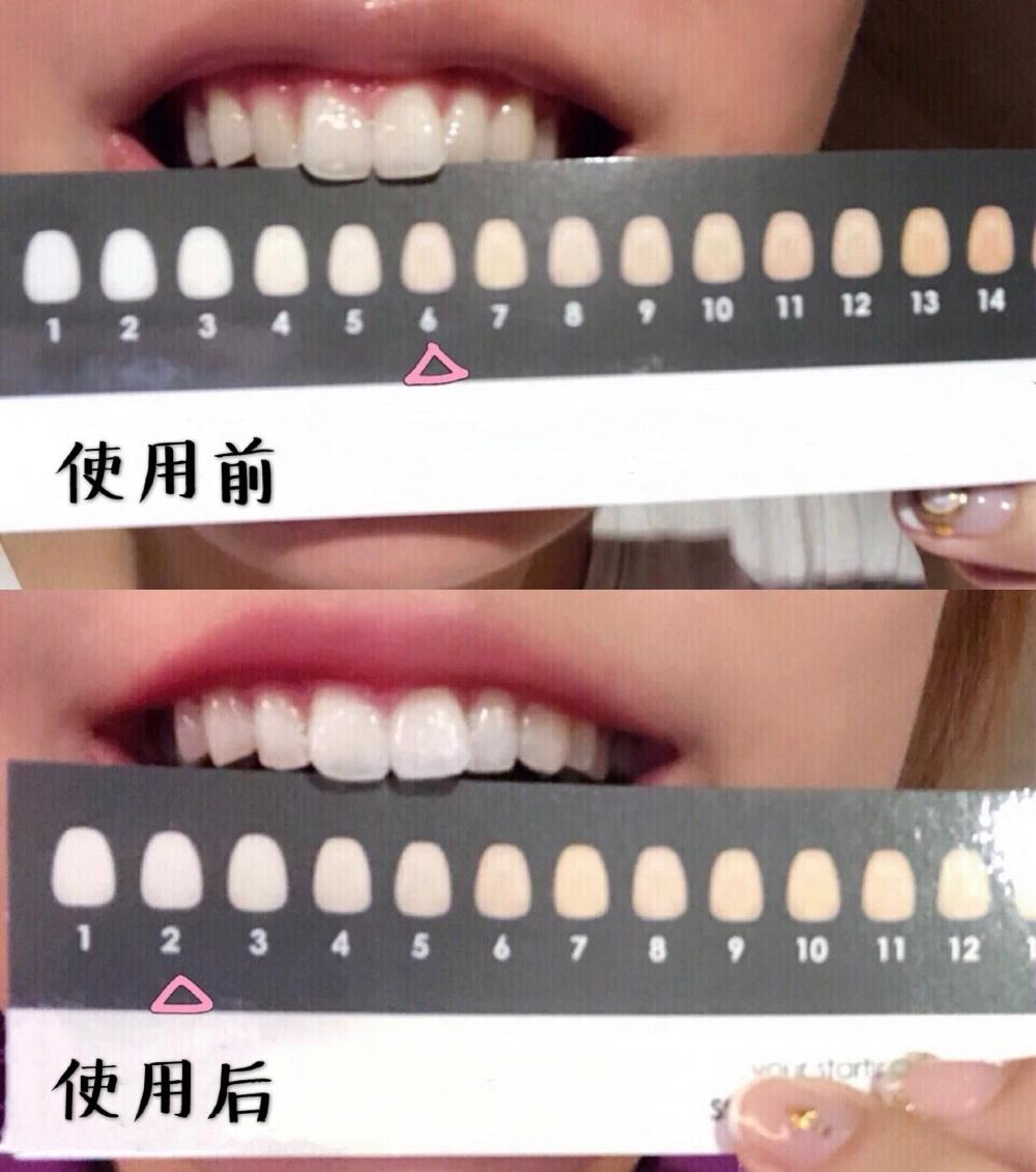 口腔专用香水,能持久留香的口腔香水