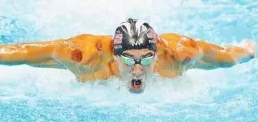 拔罐疗法的现代理论,拔罐是火罐还是真空罐好