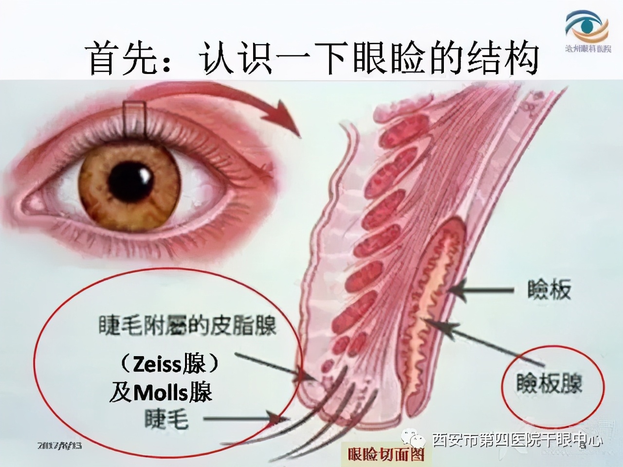 麦粒肿攻略,麦粒肿如何自己正确涂药膏