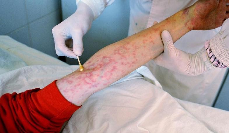 哪些疾病是通过性传播的,哪些病会通过性传播