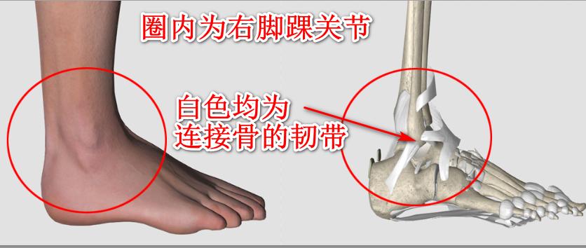 踝关节扭伤的处理办法视频,踝关节扭伤有积液怎么处理