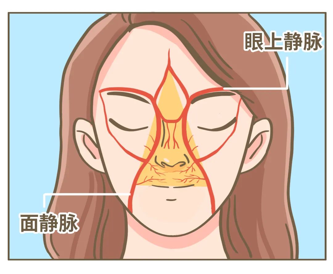 男子因其痘痘引发颅内脓肿,二十多岁小伙子肛周脓肿