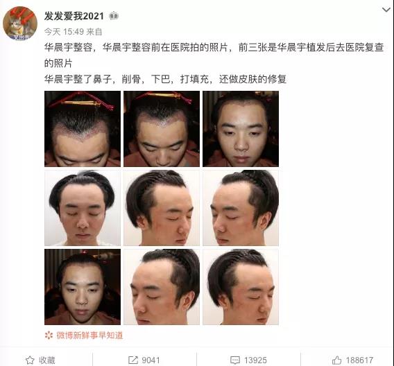 华晨宇被爆出轨整容，内娱嫂子锤渣男，终于开始内卷了