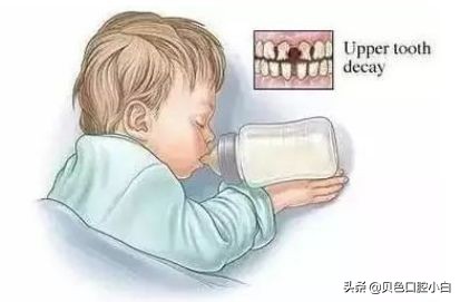 宝宝牙齿黄黄的刷不干净怎么办,宝宝不爱刷牙牙齿黑了怎么办