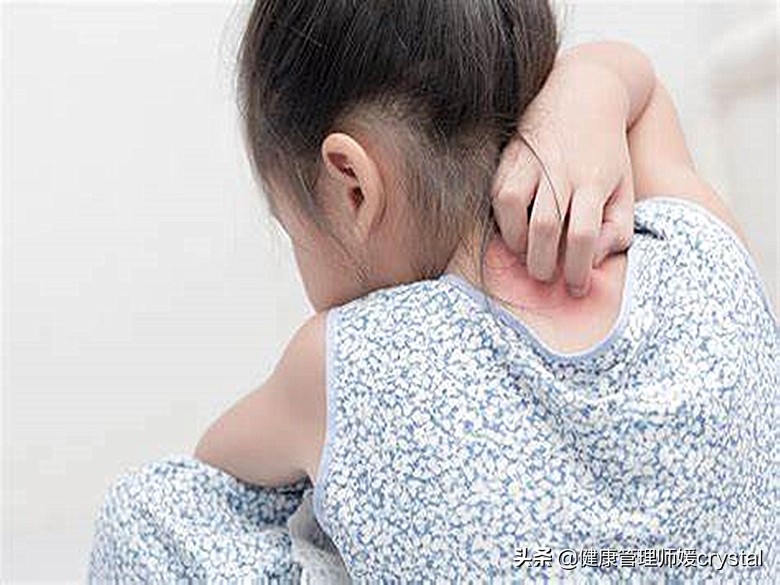 换季宝宝皮肤干痒红教你这样护理,宝宝皮肤容易过敏用什么护肤品好