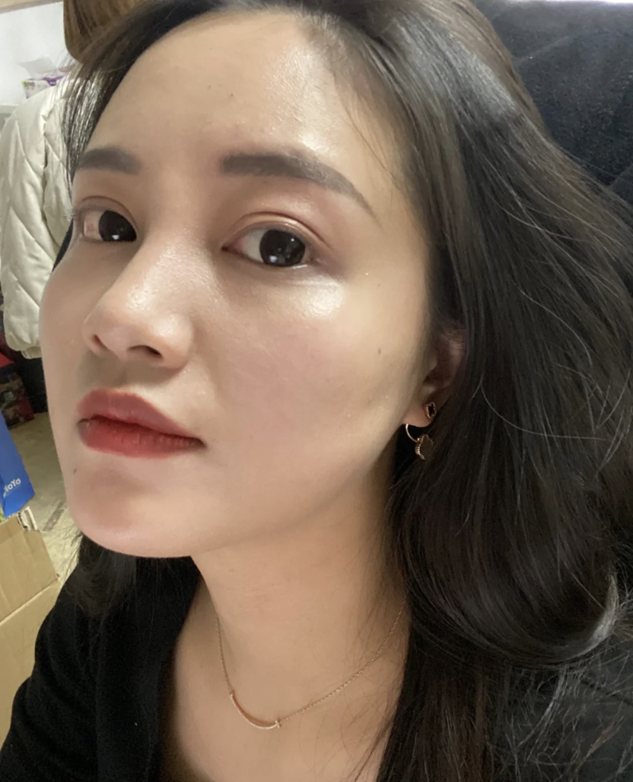 30岁之前不长痘30以后频繁长痘,30岁还一直长痘该怎么样护肤