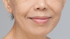 鱼尾纹法令纹抬头纹显老又难看,法令纹鱼尾纹抬头纹哪个最难看