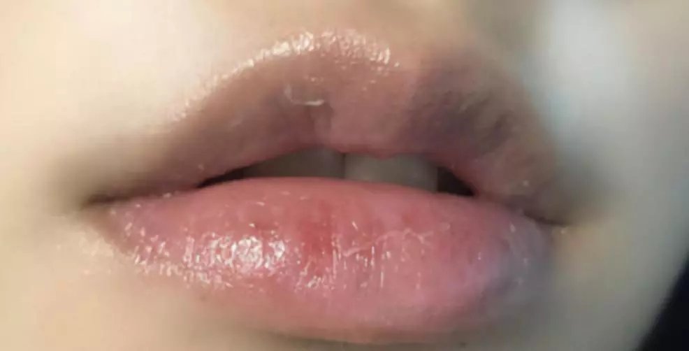 护唇日夜呵护滋润小嘴唇,冬季护唇技巧