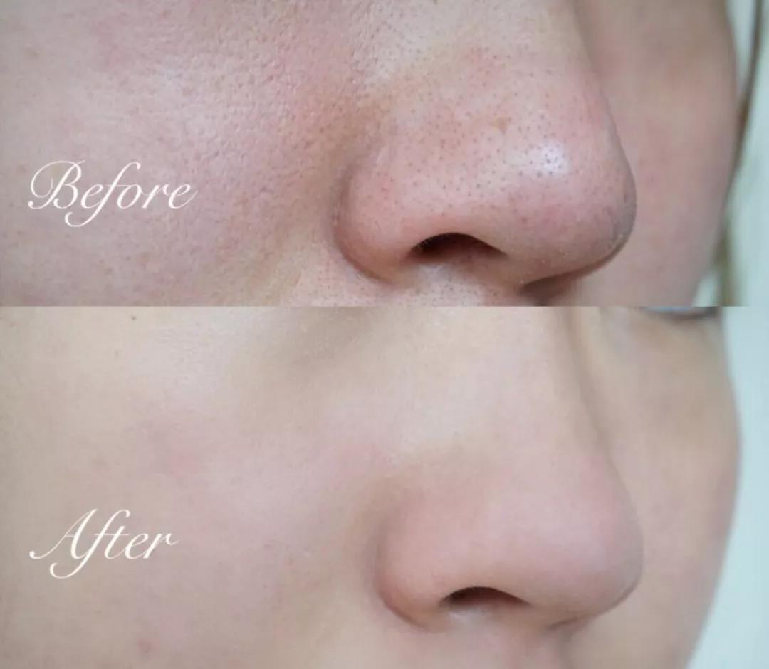 欧莱雅花萃净柔卸妆膏试用报告,欧莱雅眼唇卸妆液测评分析图