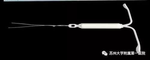 痛经医生建议上环,为什么医生建议上环而不是结扎