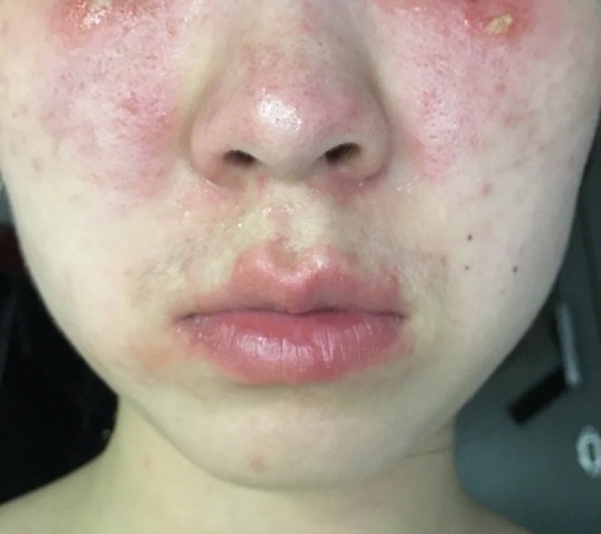 敏感肌慎入的化妆品,敏感肌护肤品兰蔻