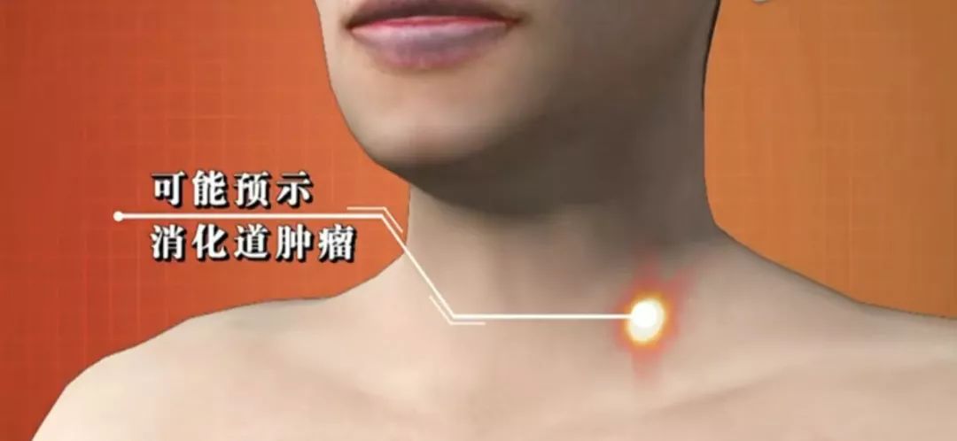 人体危险三角区的危害,身体三角区有哪些危险