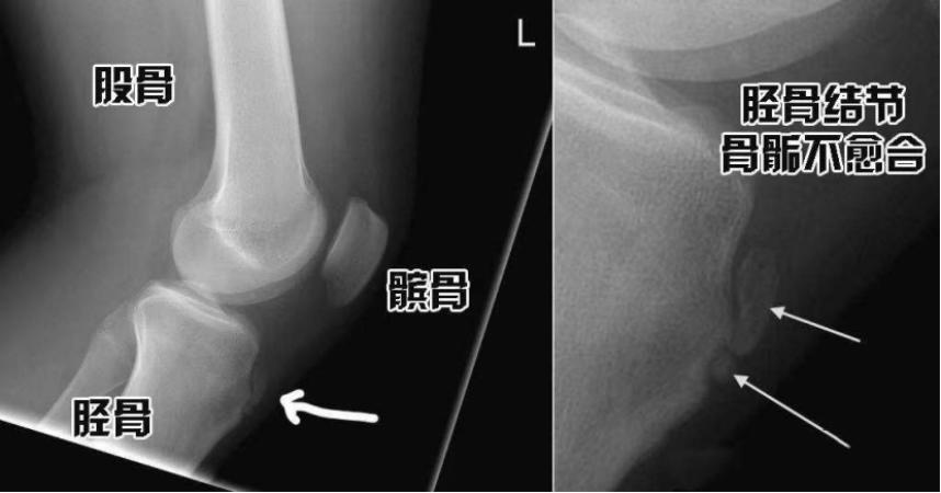 跳绳怎么解决跳两下的问题,跳绳跳出问题