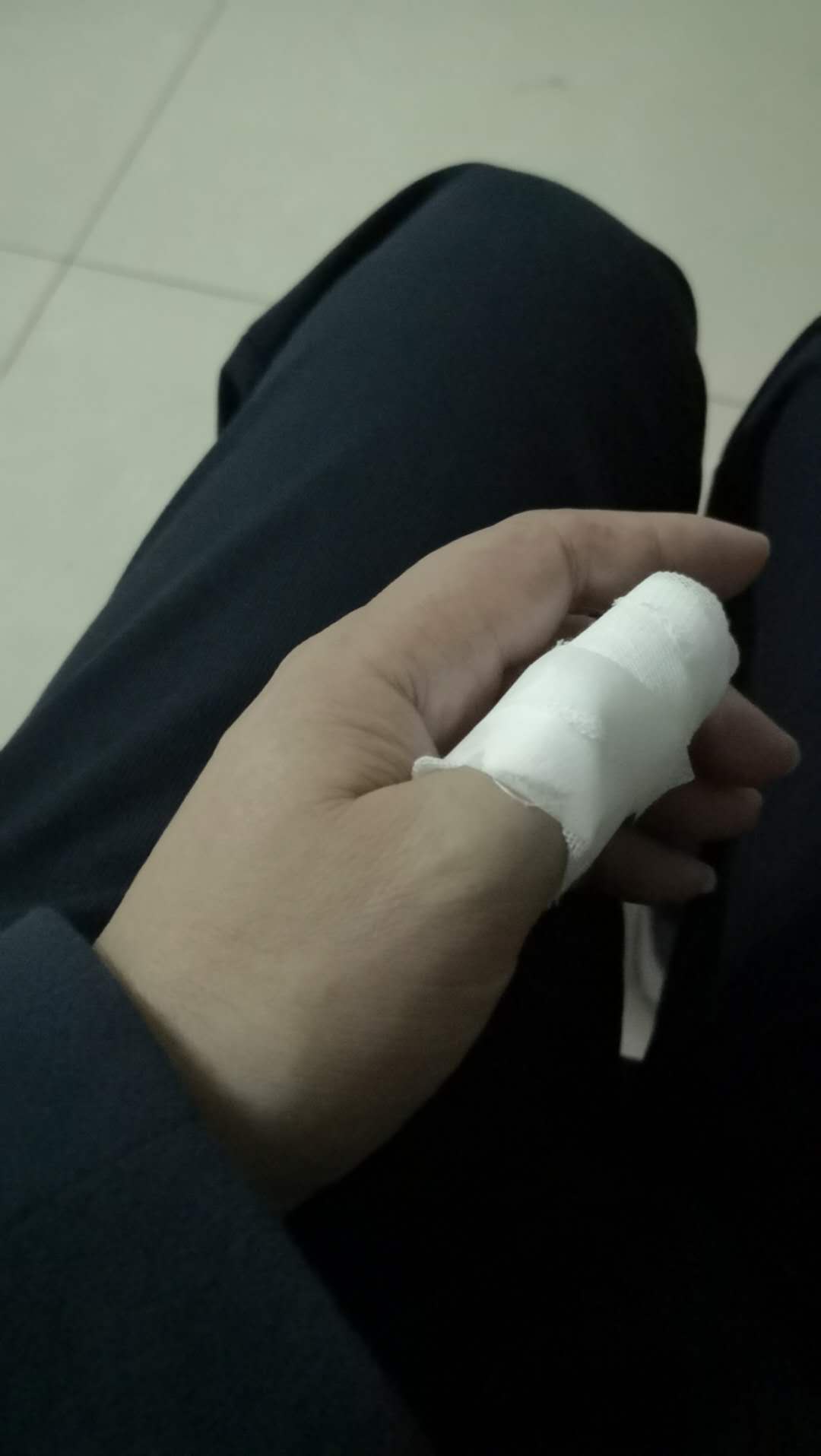 被压坏的指甲生长过程,摔倒就掉指甲是怎么回事