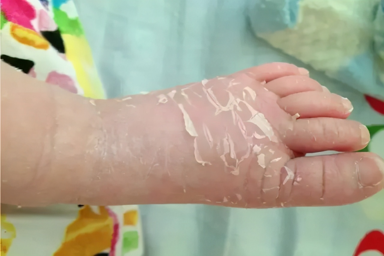 秋季宝宝护肤小技巧你get到了吗,宝宝秋季皮肤干燥用什么护肤品好