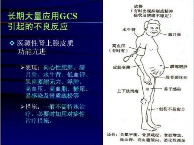 小孩退热又发热怎么办,孩子发热退热最快的方法