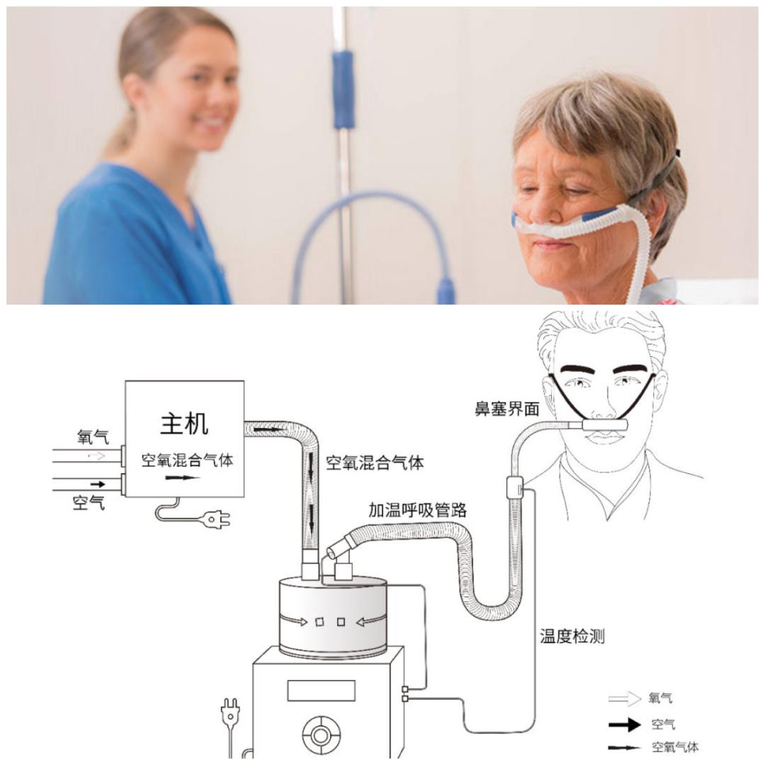 icu对患者实施必要的保护性治疗吗,icu生命支持系统