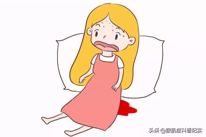 腺肌症诊刮会引起大出血吗,腺肌症能做诊刮吗