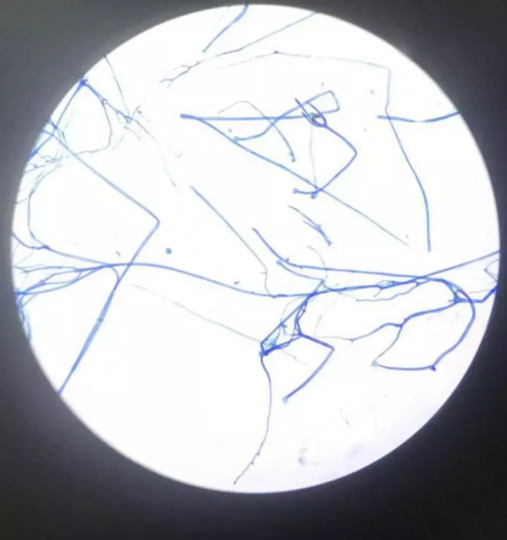 mngs病原检测的优势,mngs真的可靠吗