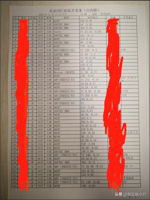 什么手术对白内障最好,老人家最先进的白内障手术过程