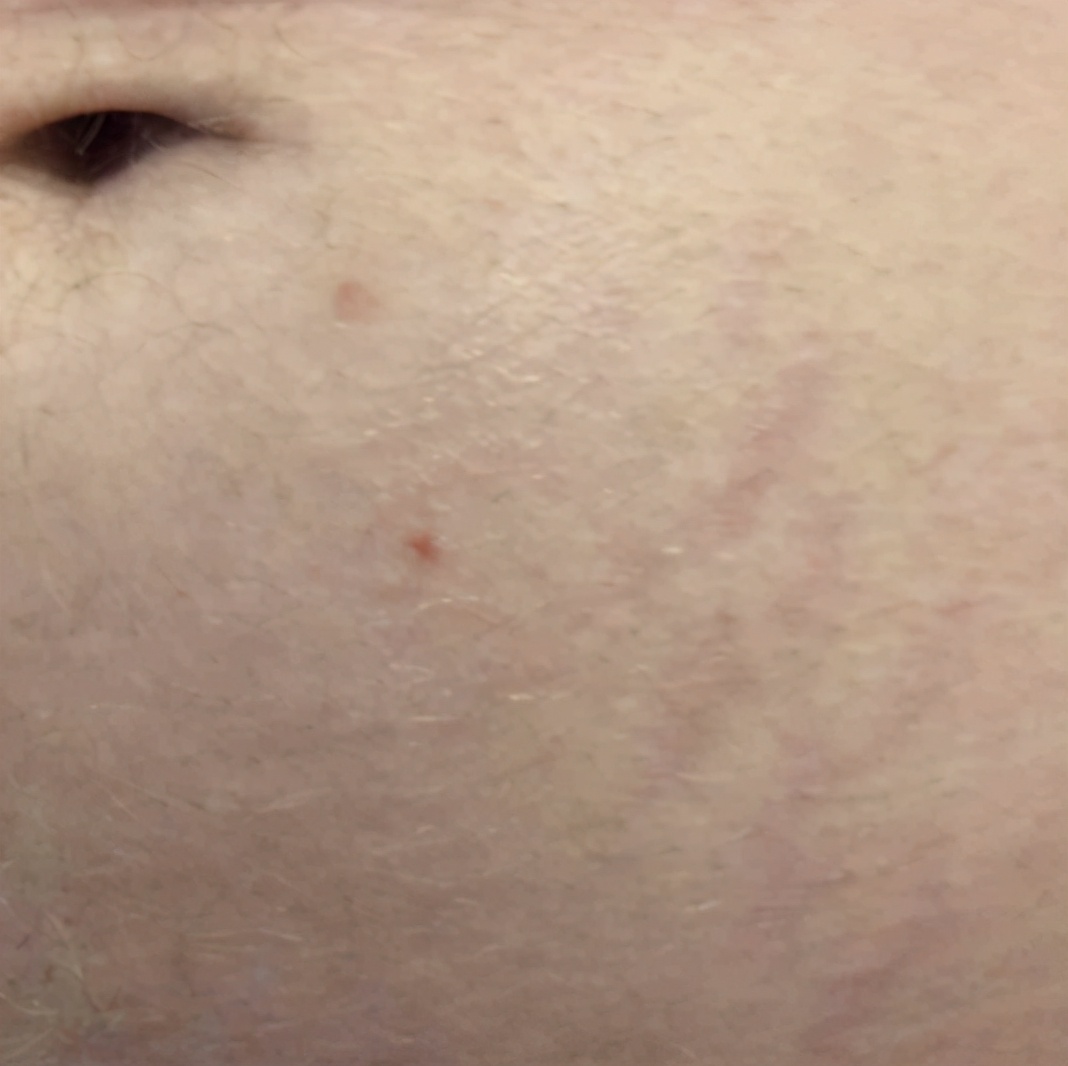 医生推荐防妊娠纹,搞定妊娠纹几十块钱就够了