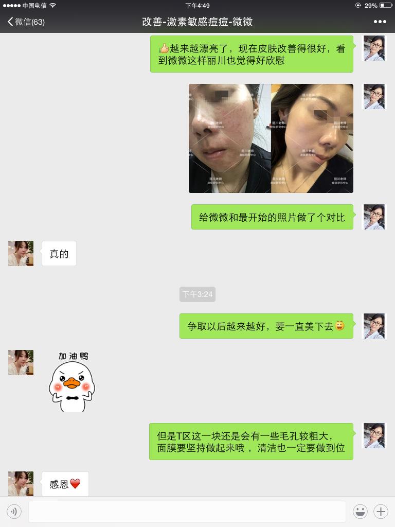 兰亭护肤品能治疗激素脸吗,兰亭化妆品嫩白祛斑霜