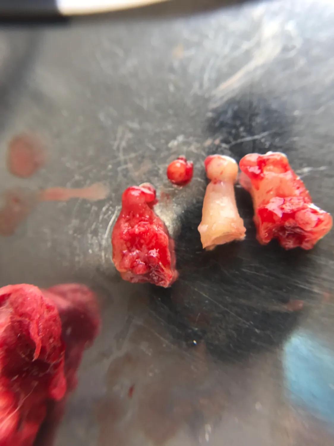 口腔垃圾怎么处理,口腔护理中的垃圾怎么分类处理