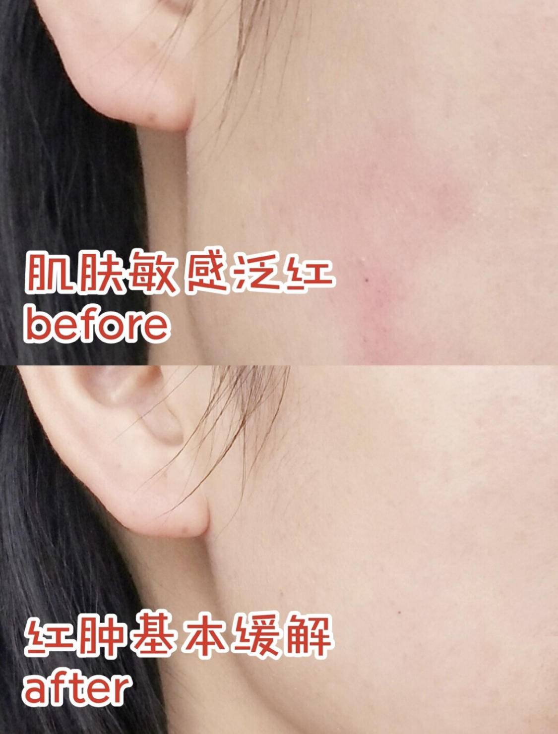 敏感肌肤抗衰产品推荐女,敏感肌好物推荐