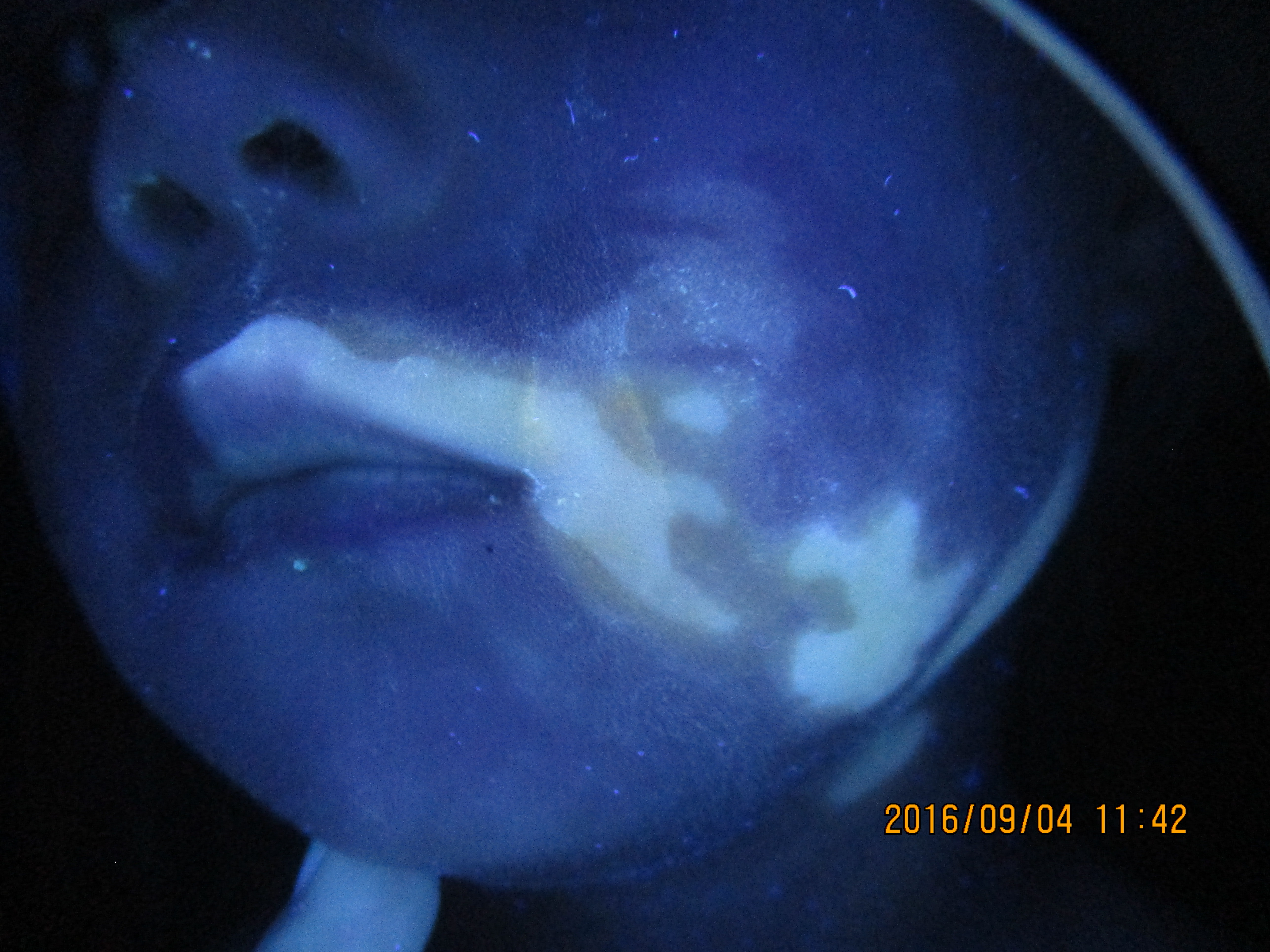 小孩脸上长白斑怎么办,儿童脸部长白斑怎么办