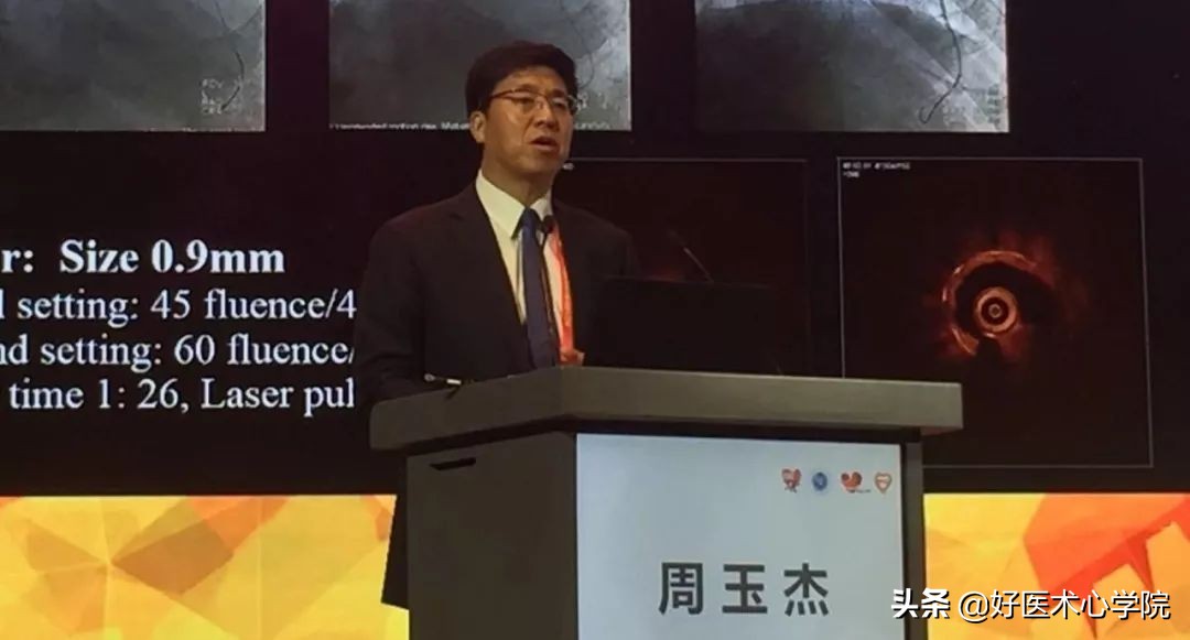 安贞医院冠心病介入治疗新技术,冠心病介入术