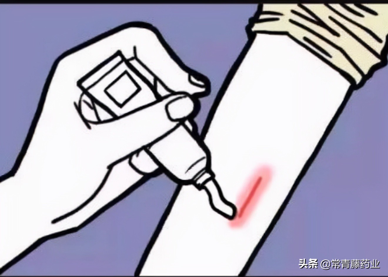 爱美之心,人皆有之,瘢痕的这些事是你想要知道的吗?