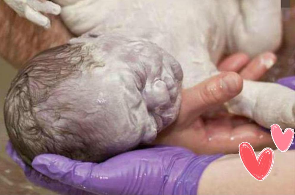 生下来丑宝宝怎么办,刚生出来的宝宝真丑