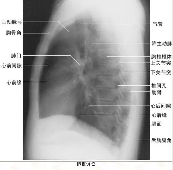 拿到胸部ct我们该怎么看,怎样看懂胸片报告单