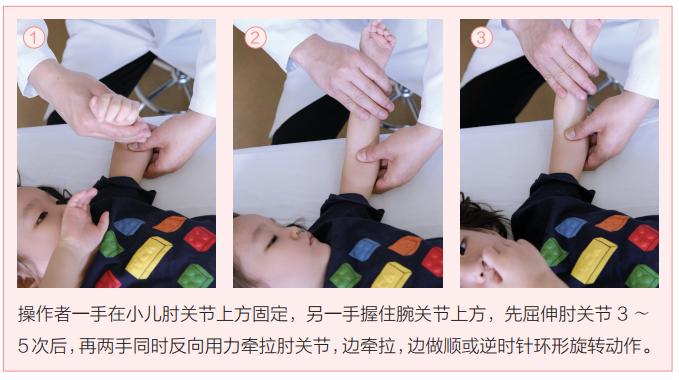 小儿斜颈大小眼推拿,小儿大拇指推拿手法