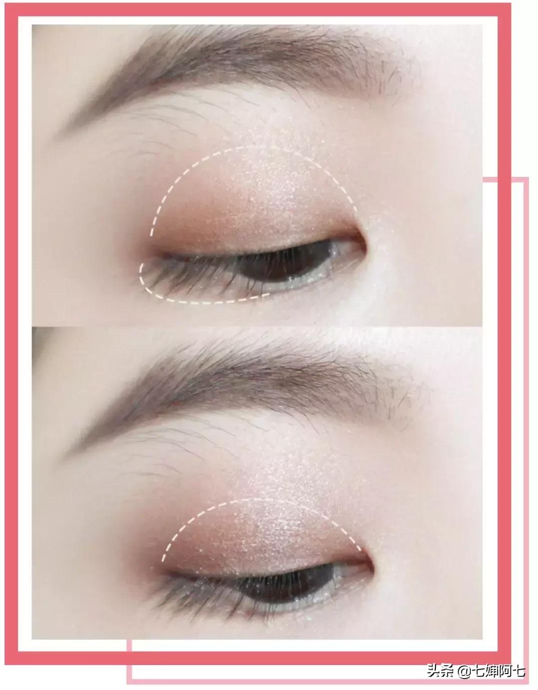 快速消肿肿眼泡,快速拯救眼睛黑眼圈